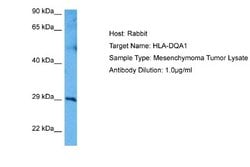 HLA DQ3 Rabbit anti-Human, Polyclonal, Novus Biologicals 0.1 mL | Buy Online | Novus Biologicals | Fisher Scientific